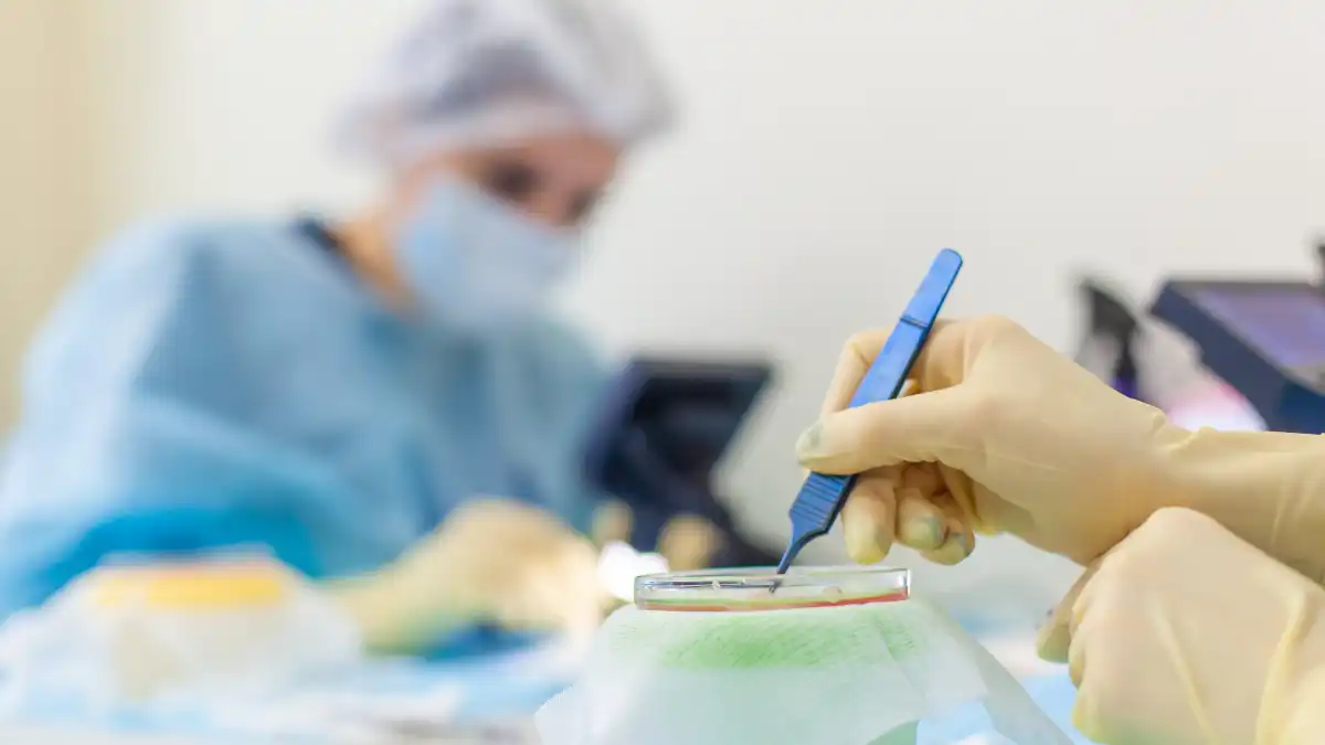 Surgeon-Led vs Technician-Led Hair Transplants: What Every Patient Should Know